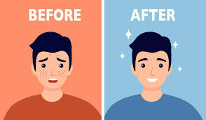 Before and After CapCut Template